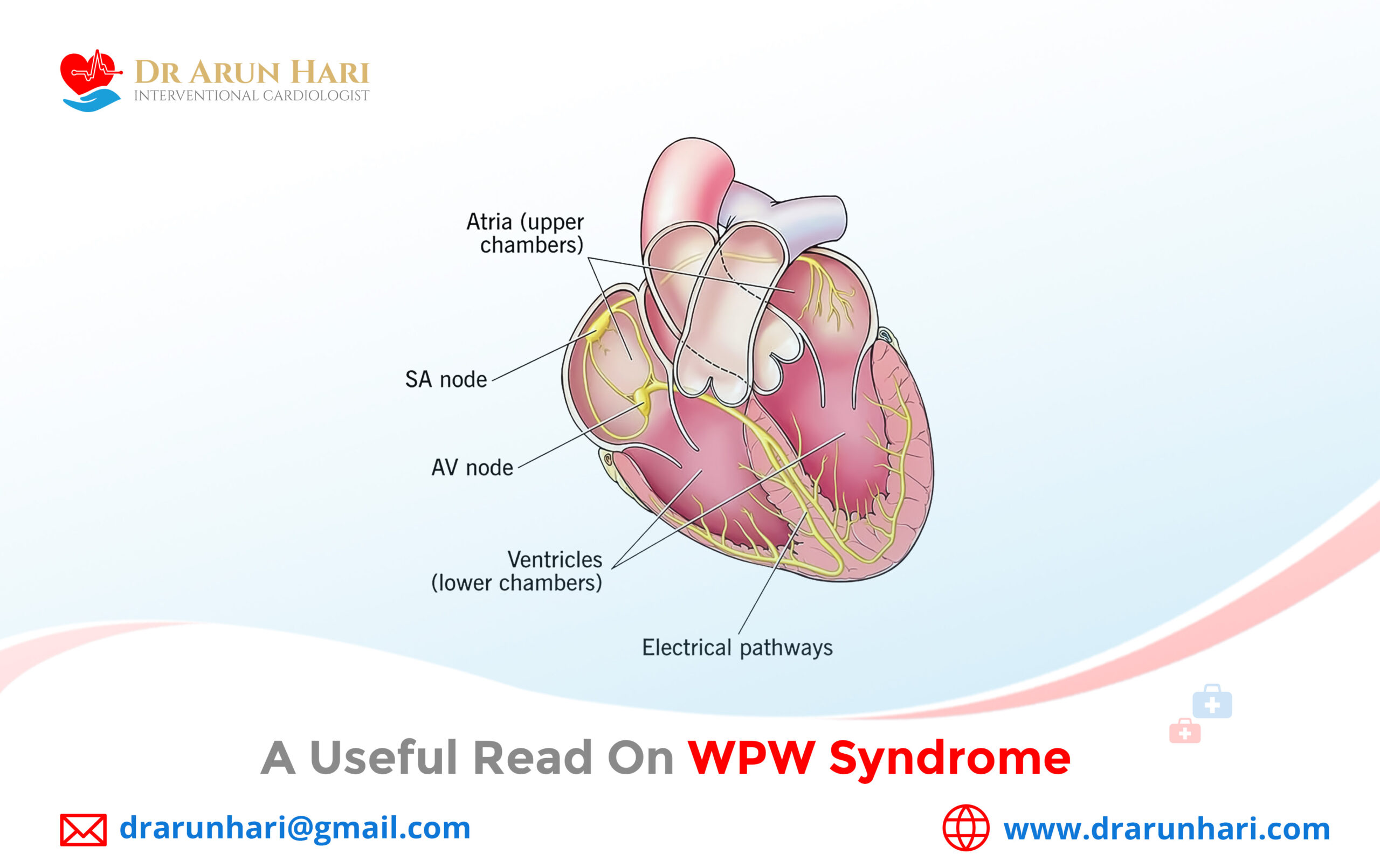 Read more about the article A Useful Read on WPW Syndrome
