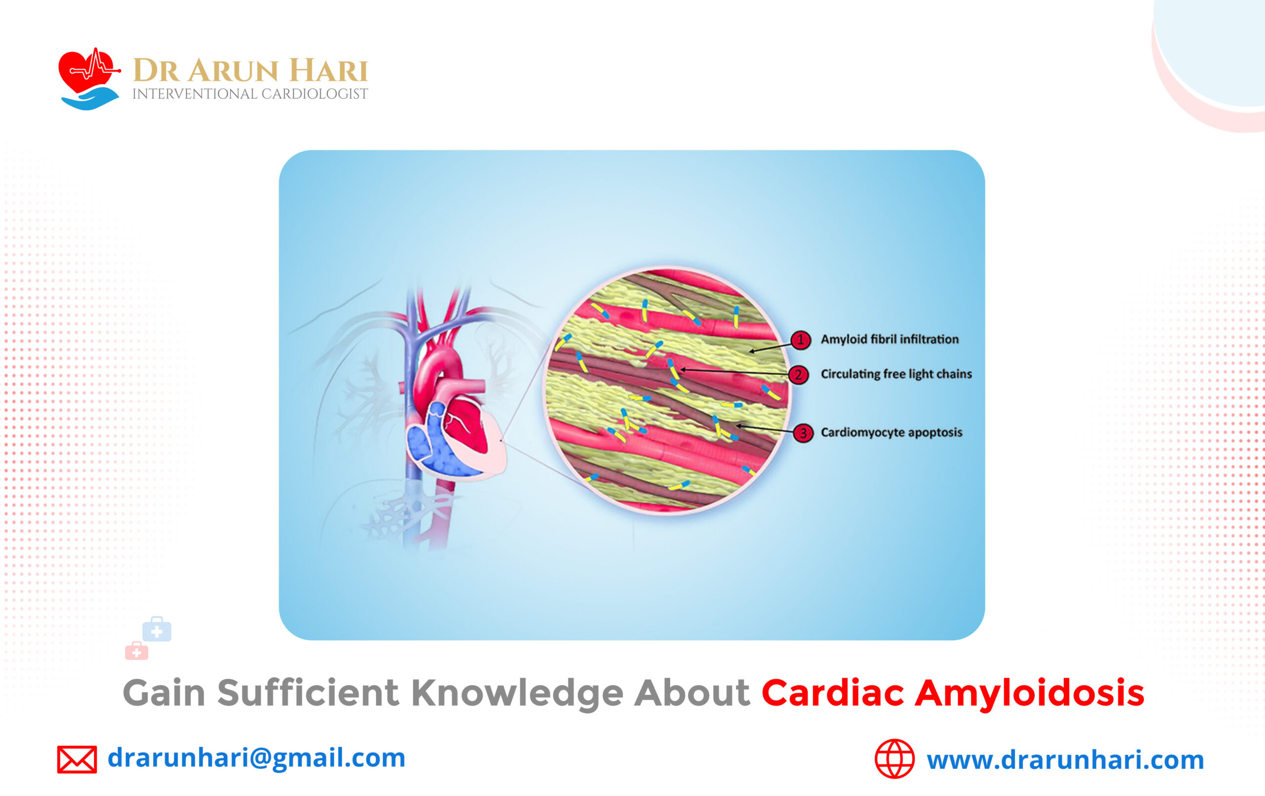 Read more about the article Gain Sufficient Knowledge about Cardiac Amyloidosis