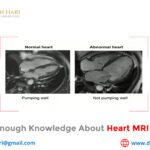 Gather Enough Knowledge about Heart MRI