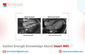Read more about the article Gather Enough Knowledge about Heart MRI