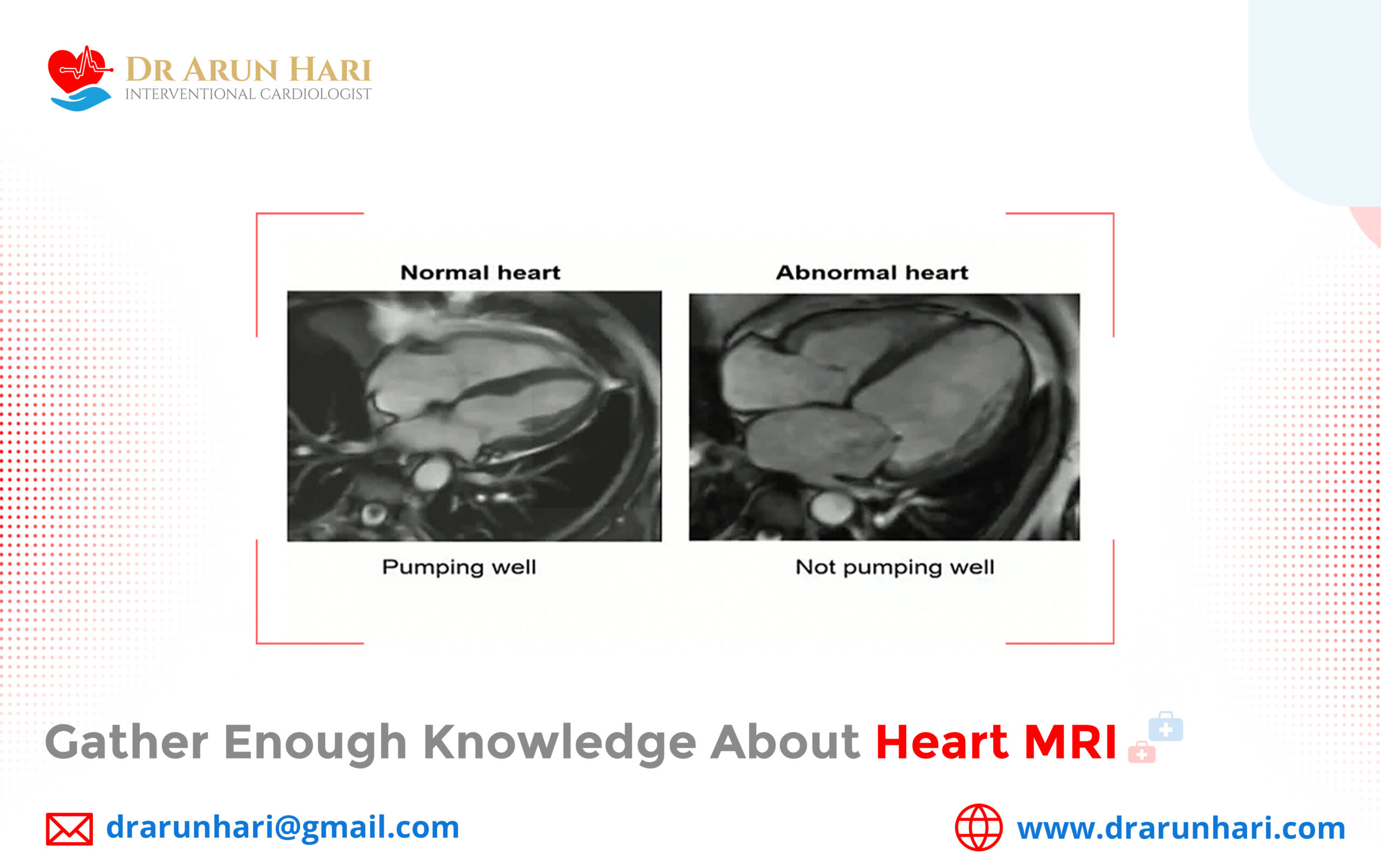You are currently viewing Gather Enough Knowledge about Heart MRI