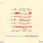 Understand the Sound of Heart Murmurs!