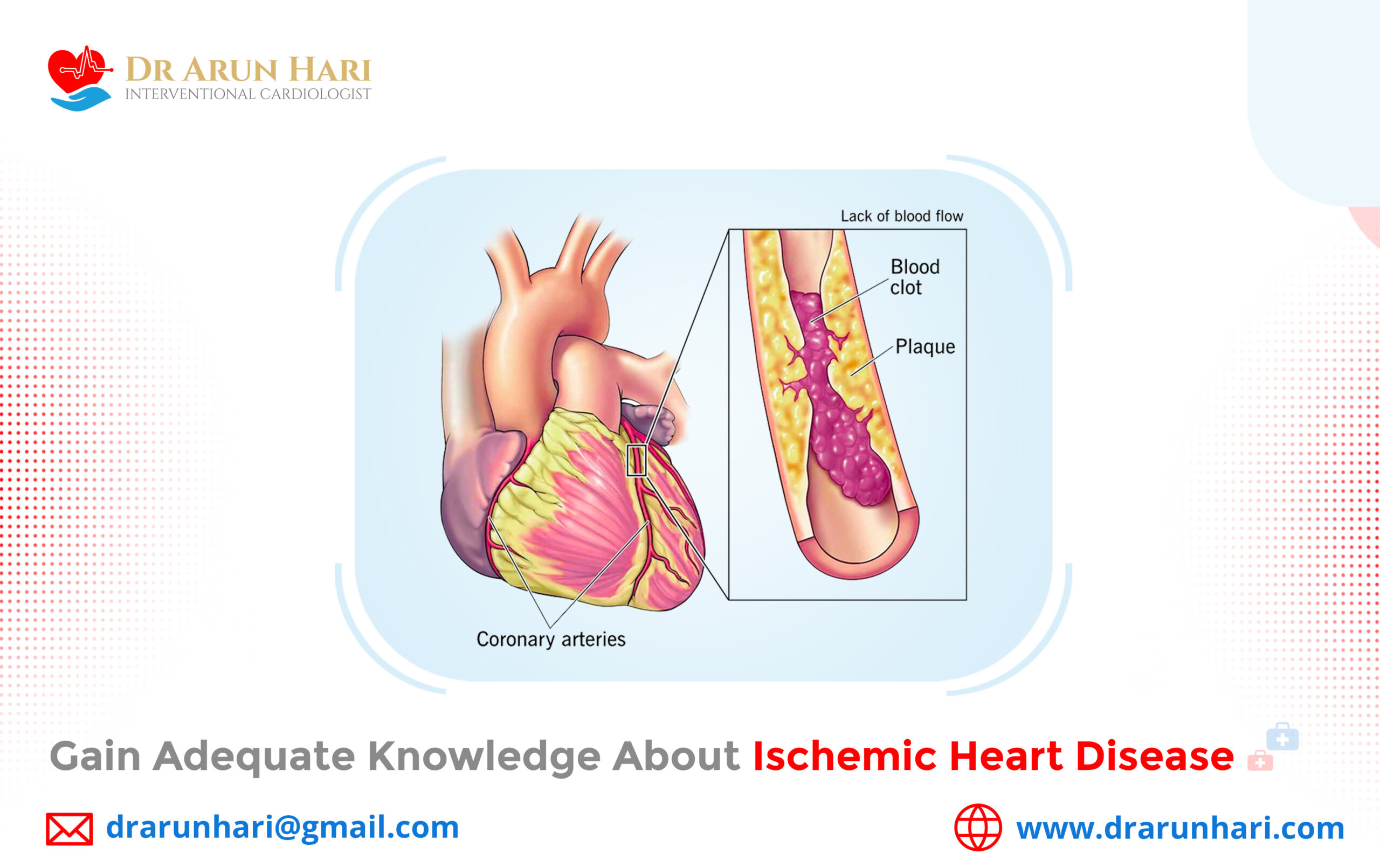 Read more about the article Gain Adequate Knowledge about Ischemic Heart Disease