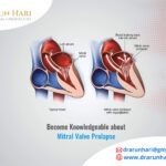 Become Knowledgeable about Mitral Valve Prolapse