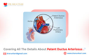 Read more about the article Covering All the Details about Patent Ductus Arteriosus