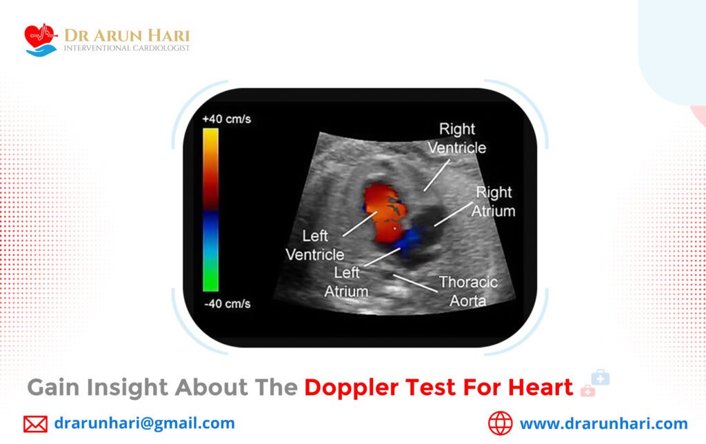 Gain Insight about the Doppler Test for Heart