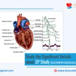 Study the Significant Details about EP Study