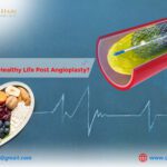 How to Lead a Healthy Life Post Angioplasty?