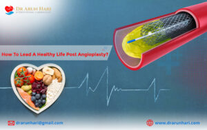 Read more about the article How to Lead a Healthy Life Post Angioplasty?