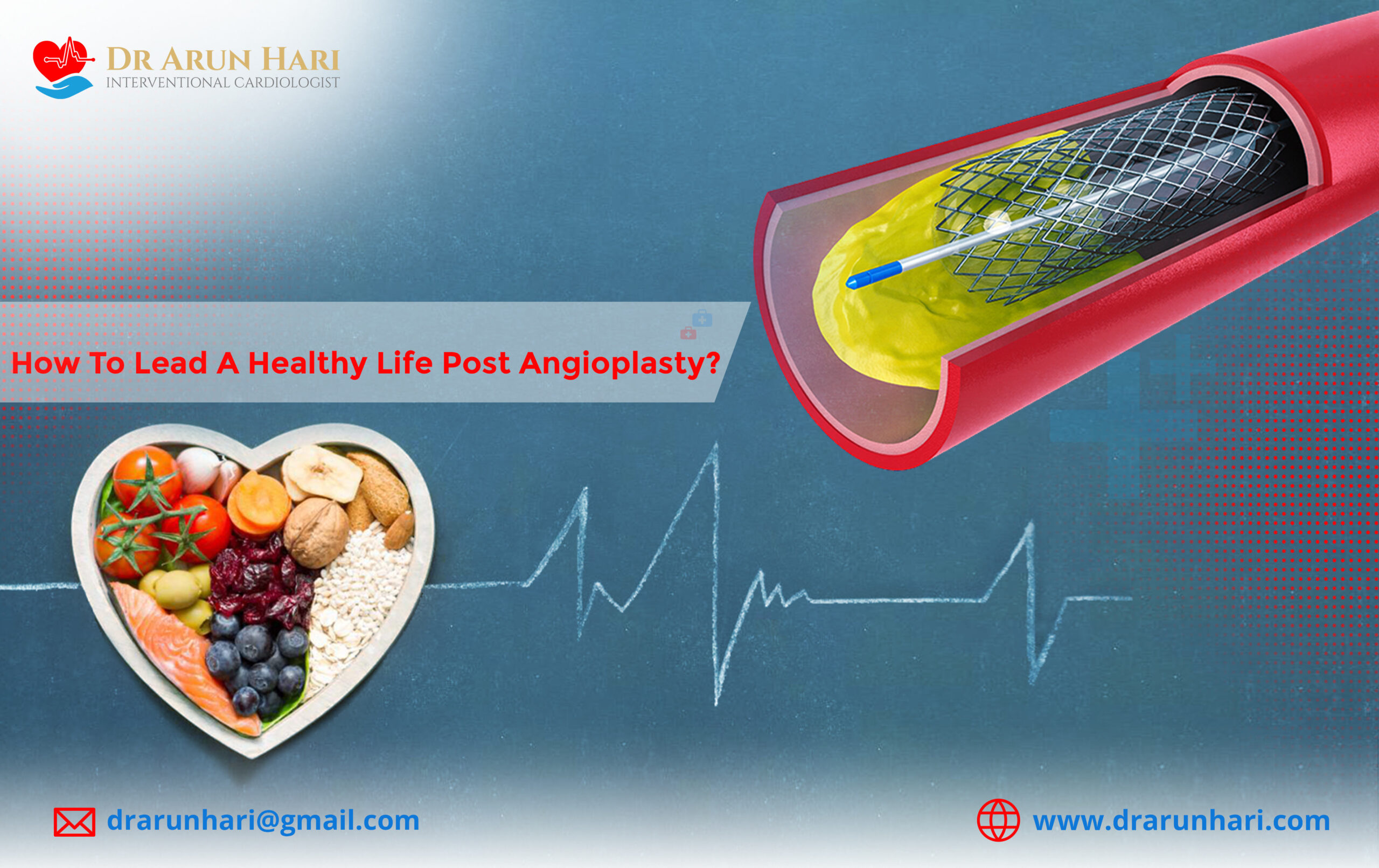 You are currently viewing How to Lead a Healthy Life Post Angioplasty?