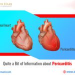 Quite a Bit of Information about Pericarditis