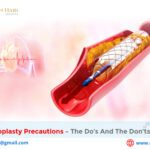 Post Angioplasty Precautions – The Do’s and the Don’ts