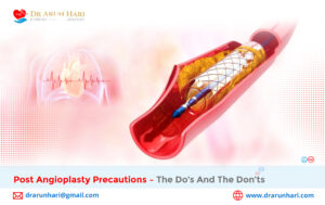 Read more about the article Post Angioplasty Precautions – The Do’s and the Don’ts