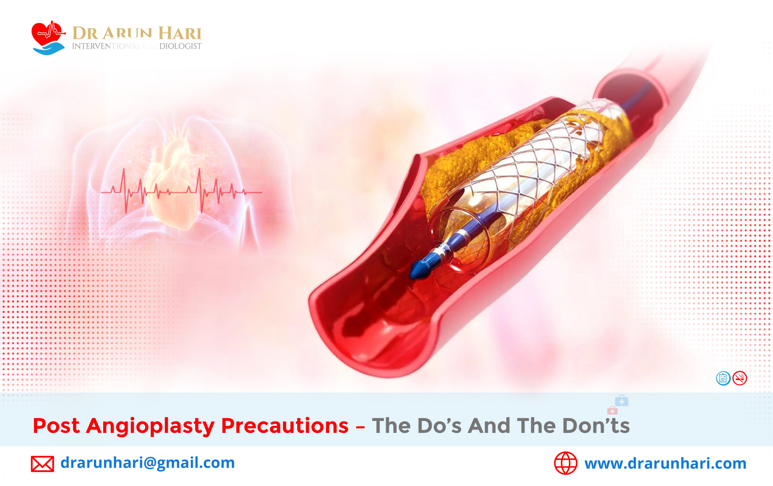 Read more about the article Post Angioplasty Precautions – The Do’s and the Don’ts
