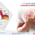 Do You Wish to Know – Is Heartburn Related to Heart?