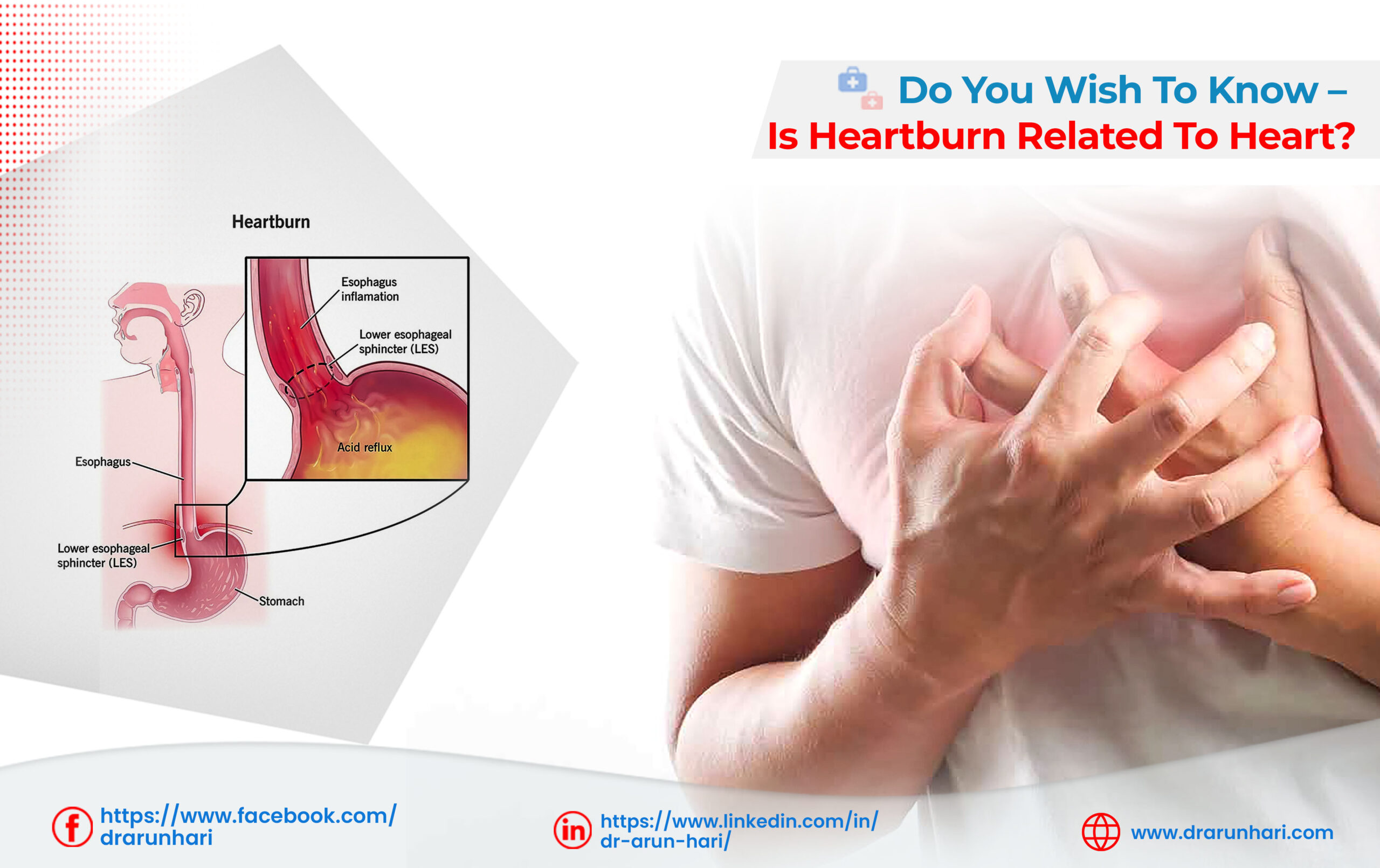 You are currently viewing Do You Wish to Know – Is Heartburn Related to Heart?