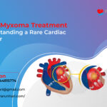 Atrial Myxoma Treatment: Understanding a Rare Cardiac Tumour