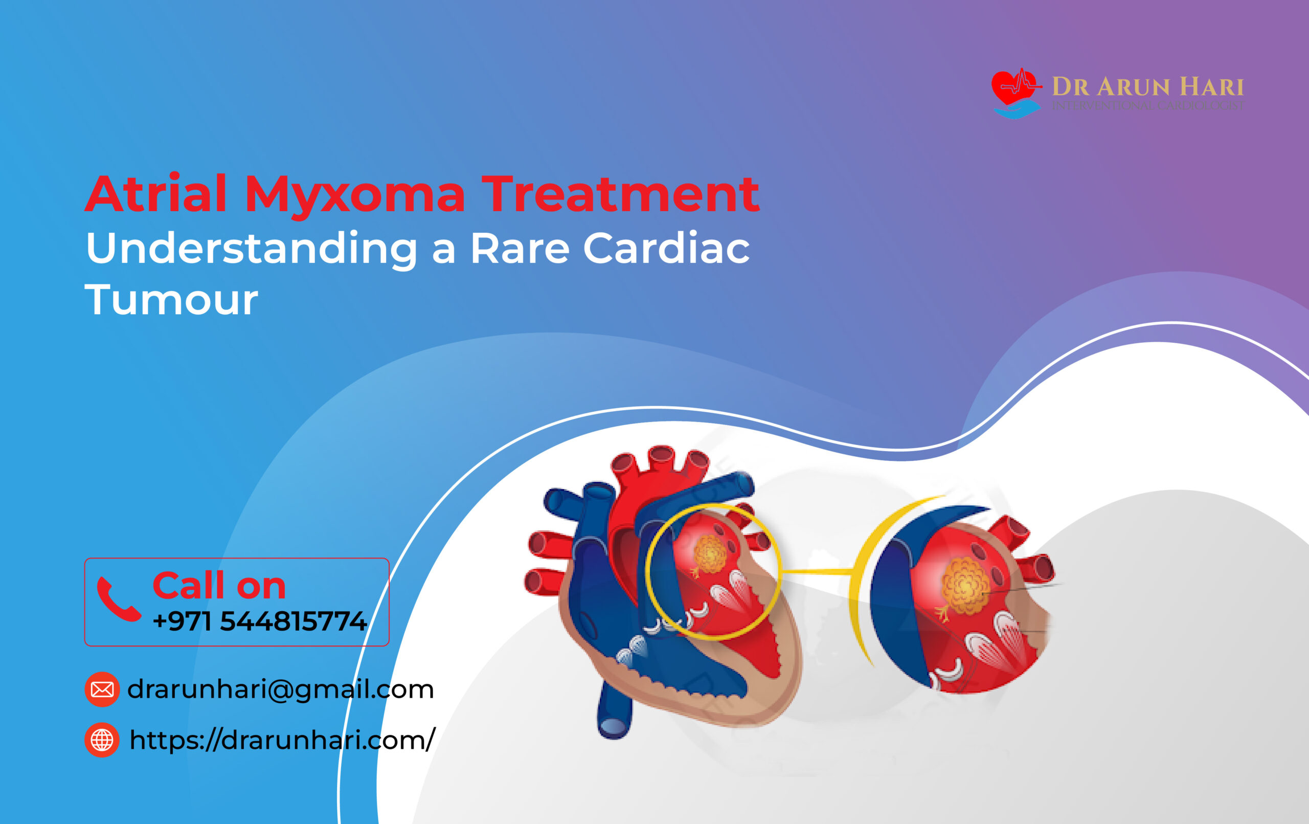 Read more about the article Atrial Myxoma Treatment: Understanding a Rare Cardiac Tumour