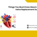 Things to Know About Aortic Valve Replacement Surgery