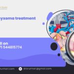 Atrial Myxoma Treatment: Understanding a Rare Cardiac Tumour