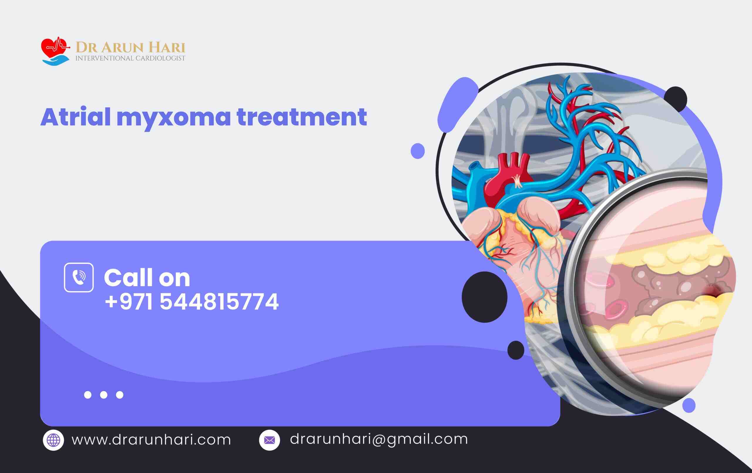 You are currently viewing Atrial Myxoma Treatment: Understanding a Rare Cardiac Tumour