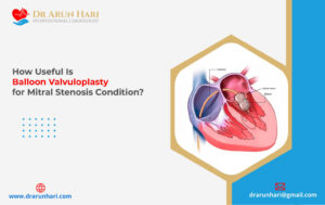 Read more about the article Balloon Valvuloplasty for Mitral Stenosis – How Useful Is It?