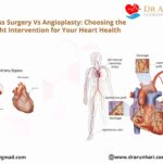 Bypass Surgery Vs Angioplasty: Choosing the Right Heart Intervention