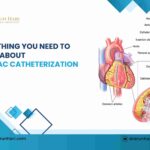 Everything You Need to Know About Cardiac Catheterization!