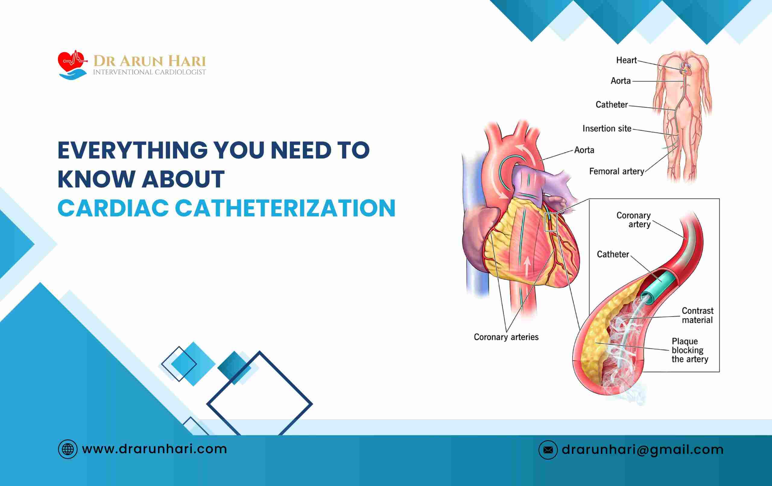 You are currently viewing Everything You Need to Know About Cardiac Catheterization!