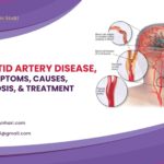 Carotid Endarterectomy – Why It’s Done & What to Expect?