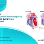 Hypertrophic Cardiomyopathy: Causes, Symptoms, & Treatment