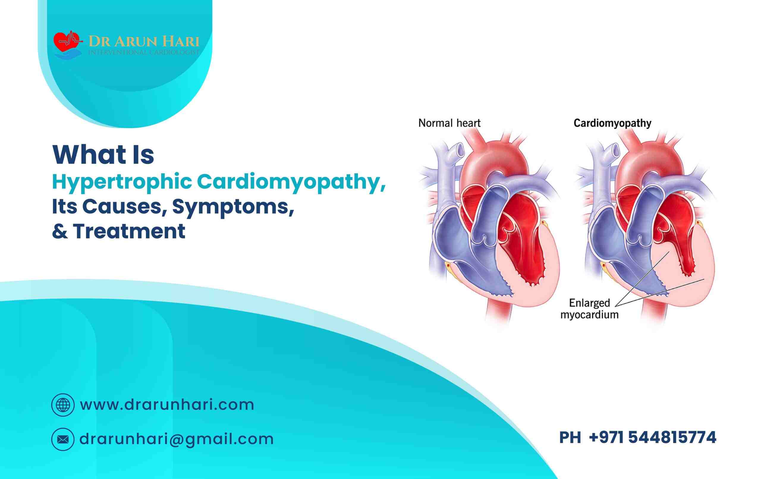 You are currently viewing Hypertrophic Cardiomyopathy: Causes, Symptoms, & Treatment