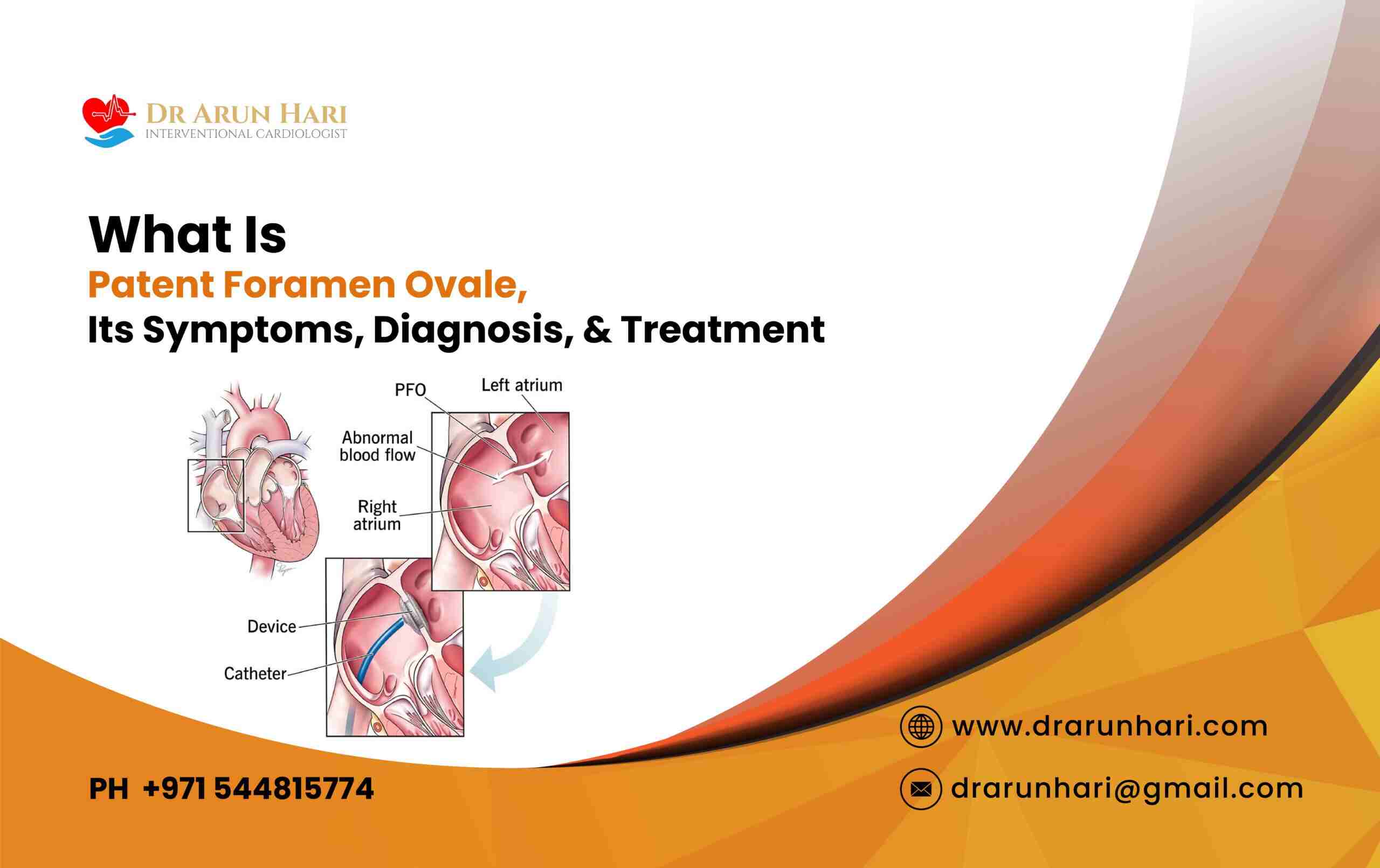 Read more about the article Patent Foramen Ovale – Symptoms, Diagnosis, & Treatment