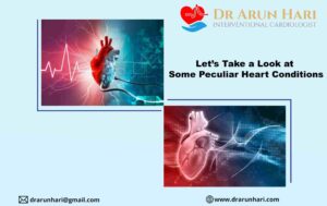 Read more about the article Let’s Take a Look at Some Peculiar Heart Conditions