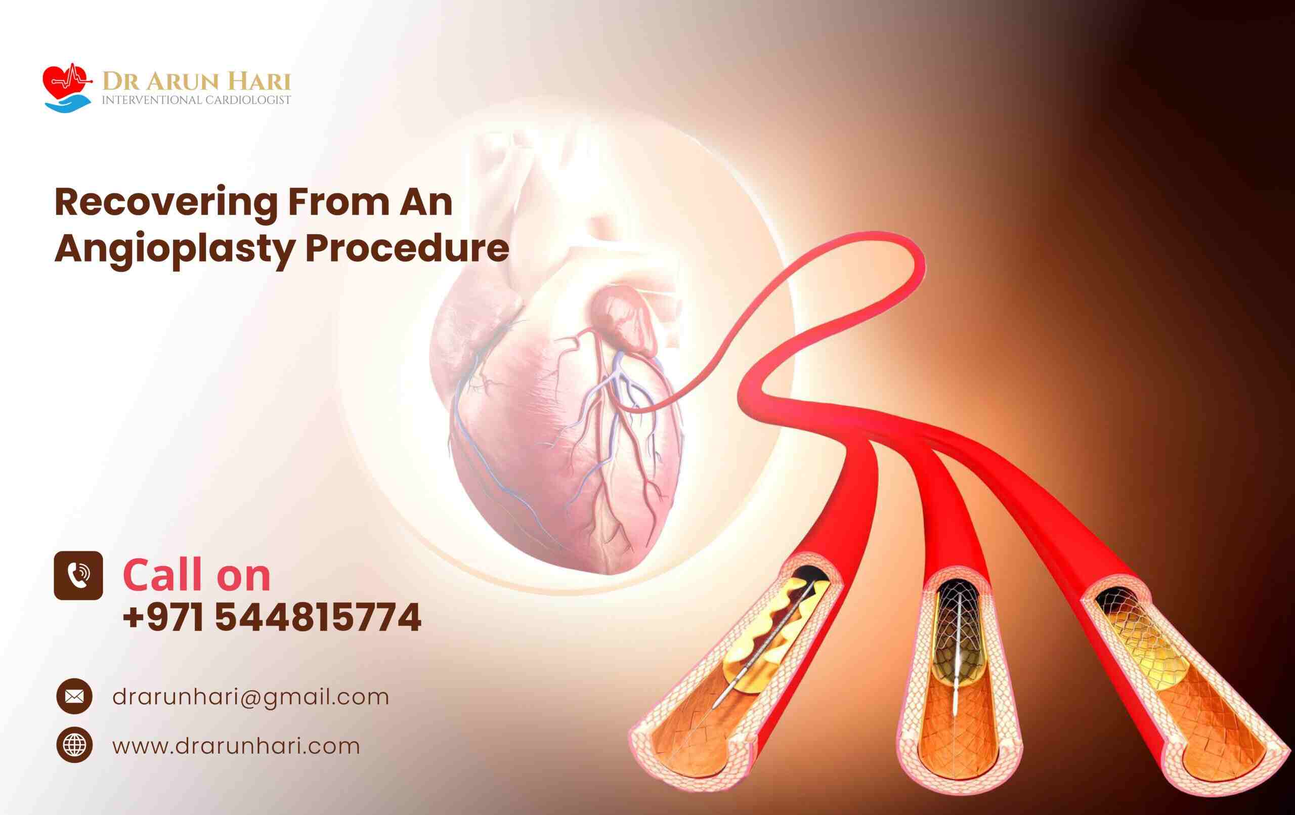 You are currently viewing Recovering From An Angioplasty Procedure!