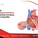 Alcohol Septal Ablation – Why & How It’s Done, Its Risks & Benefits