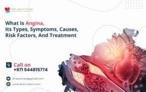 Read more about the article Angina: Types, Symptoms, Causes, Risks, & Treatment