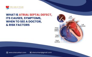 Read more about the article Atrial Septal Defect: Causes, Symptoms, When To See a Doctor, & Risks