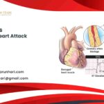 What Is A STEMI Heart Attack?