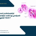 എന്താണ് ട്രാൻസ്‌കത്തീറ്റർ അയോർട്ടിക് വാൽവ് ഇംപ്ലാന്റേഷൻ അല്ലെങ്കിൽ TAVI?