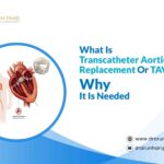 What Is Transcatheter Aortic Valve Implantation Or TAVI?