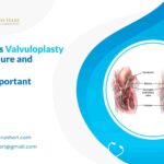 What Is Valvuloplasty Procedure & Why It Is Important?