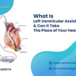 What Is LVAD?