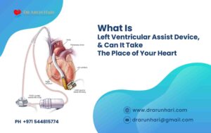 Read more about the article What Is LVAD?