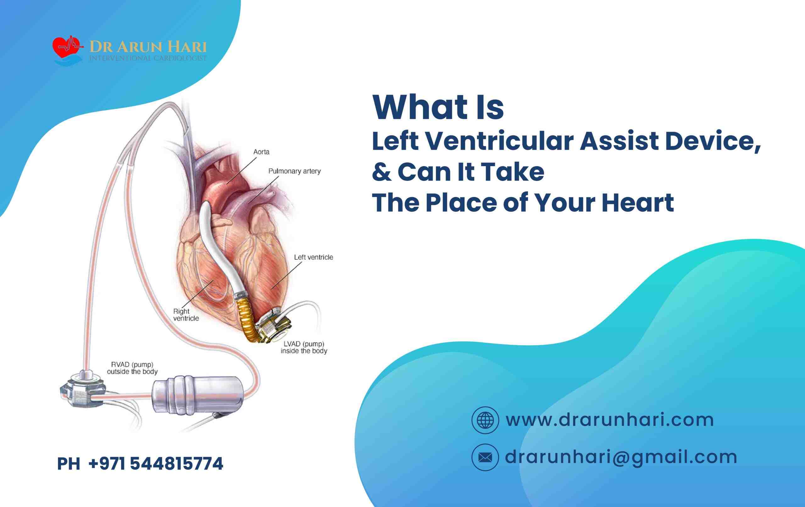 Read more about the article What Is LVAD?