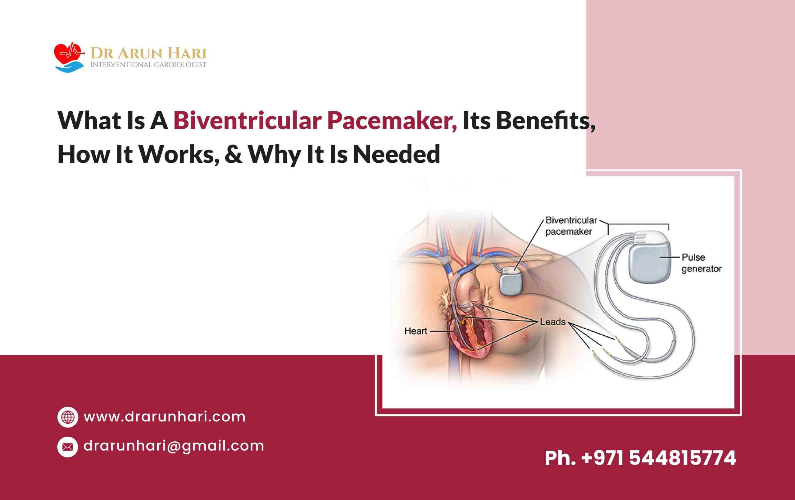 You are currently viewing Biventricular Pacemaker – Benefits, How It Works, & Why It’s Needed?