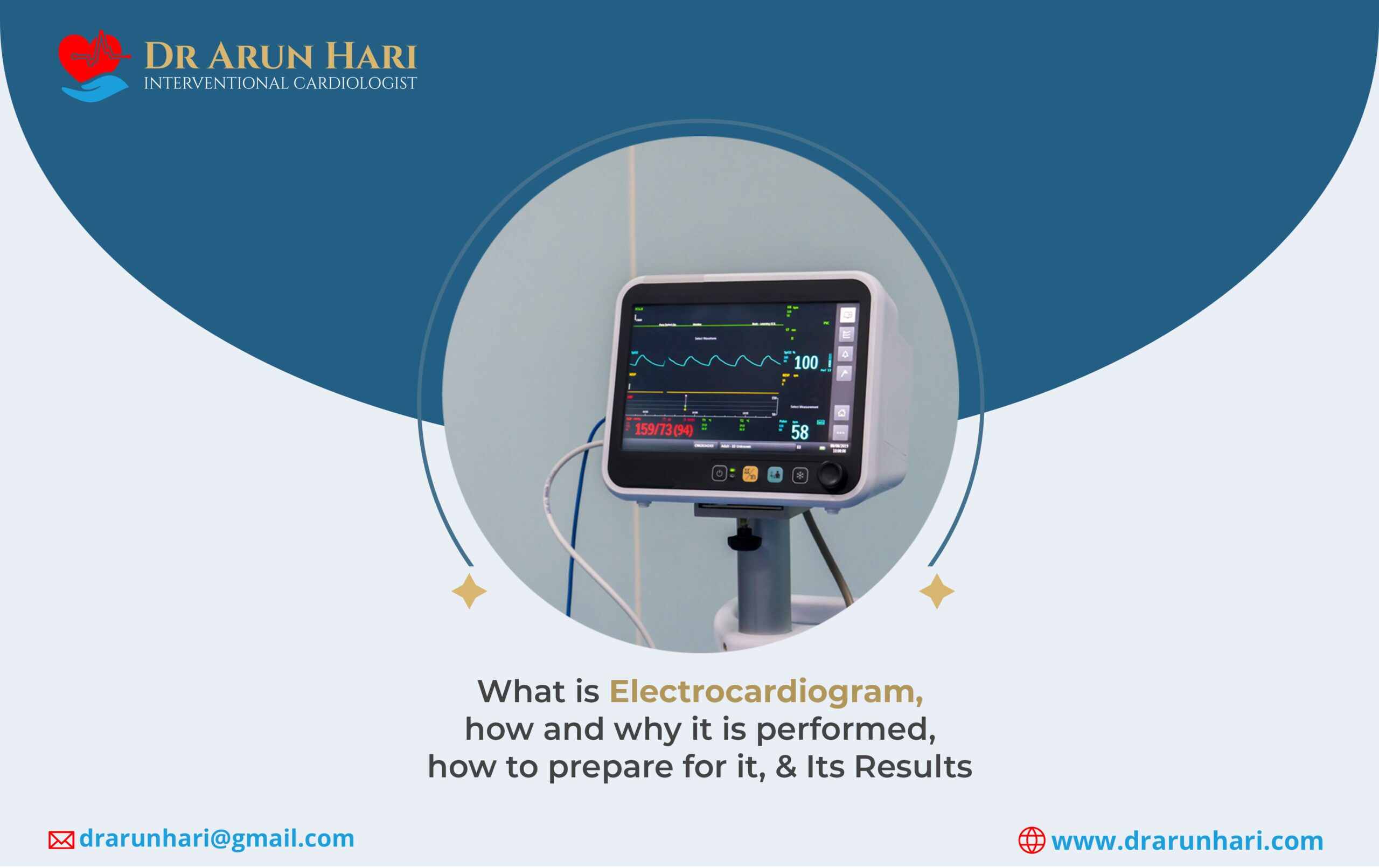 You are currently viewing Electrocardiogram: How It’s Performed, Preparation, & Results