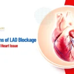 Early Symptoms of LAD Blockage: Signs of a Potential Heart Issue