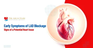 Read more about the article Early Symptoms of LAD Blockage: Signs of a Potential Heart Issue