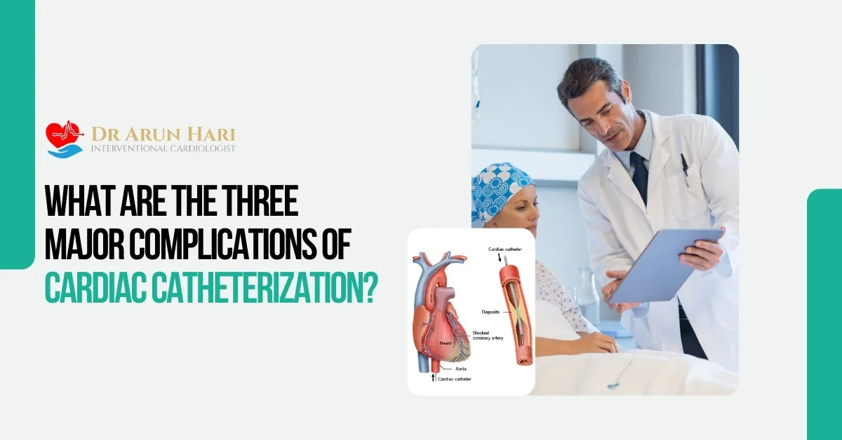 You are currently viewing What Are the Three Major Complications of Cardiac Catheterization?